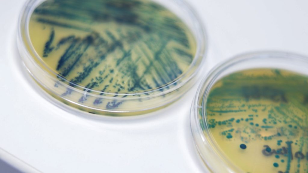 Im Labor werden Bakterien in Petrischalen gezüchtet.
