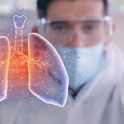 Hoffnung bei schweren Coronavirus Verläufen: Krebsmedikament kann Lungenversagen heilen