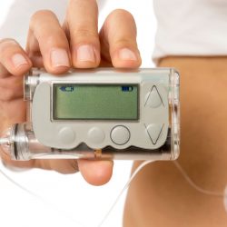 Bessere Therapie für Diabetes-Typ-1-Patienten durch Insulinpumpe?